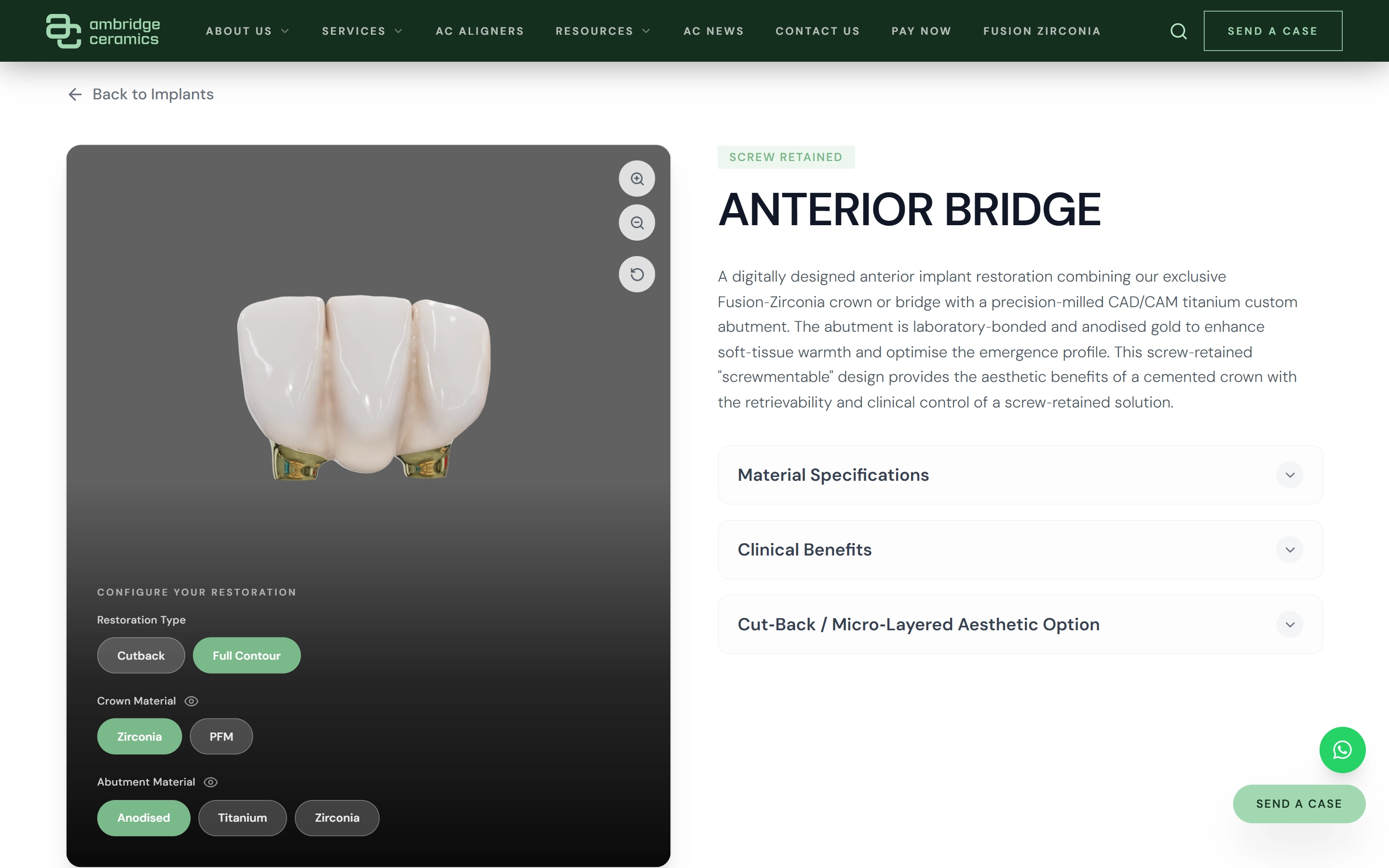 Interactive 3D product page for an anterior implant bridge on the Ambridge Ceramics website, with options for restoration type and crown and abutment material